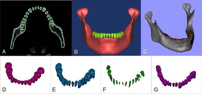 CBCT 3D Visualization